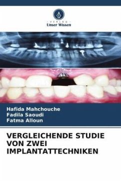 VERGLEICHENDE STUDIE VON ZWEI IMPLANTATTECHNIKEN - Mahchouche, Hafida;Saoudi, Fadila;Alloun, Fatma