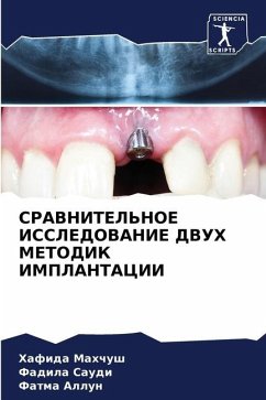 SRAVNITEL'NOE ISSLEDOVANIE DVUH METODIK IMPLANTACII - Mahchush, Hafida;Saudi, Fadila;Allun, Fatma