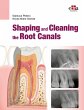 Shaping and Cleaning the Root Canals - Bild 1
