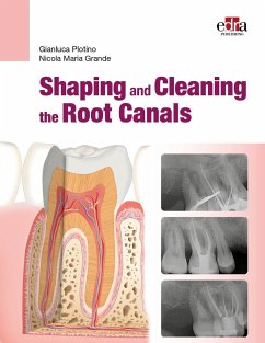 Shaping and Cleaning the Root Canal System - Plotino, Gianluca; Grande, Nicola Maria