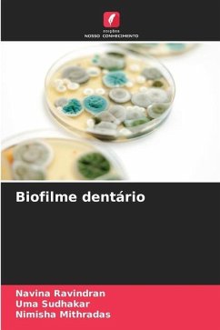 Biofilme dentário - Ravindran, Navina;Sudhakar, Uma;Mithradas, Nimisha