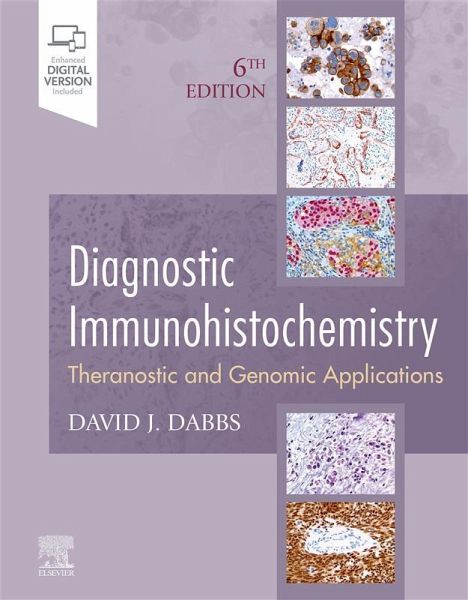 Diagnostic Immunohistochemistry E-Book (eBook, ePUB) Diagnostic Immunohistochemistry E-Book (eBook, ePUB)
