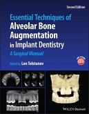 Essential Techniques of Alveolar Bone Augmentation in Implant Dentistry (eBook, ePUB)
