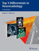 Top 3 Differentials in Neuroradiology (eBook, ePUB)