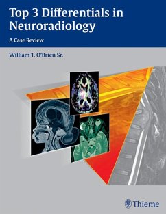 Cover Top 3 Differentials in Neuroradiology (eBook, ePUB)