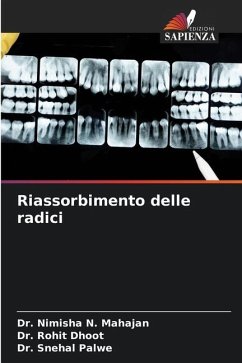 Riassorbimento delle radici - Mahajan, Dr. Nimisha N.;Dhoot, Dr. Rohit;Palwe, Dr. Snehal