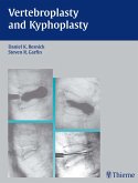Vertebroplasty and Kyphoplasty (eBook, ePUB)