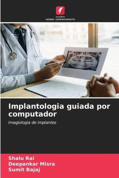 Implantologia guiada por computador - Rai, Shalu;Misra, Deepankar;Bajaj, Sumit