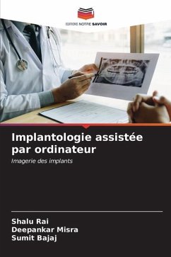 Implantologie assistée par ordinateur - Rai, Shalu;Misra, Deepankar;Bajaj, Sumit