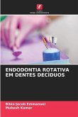 ENDODONTIA ROTATIVA EM DENTES DECÍDUOS