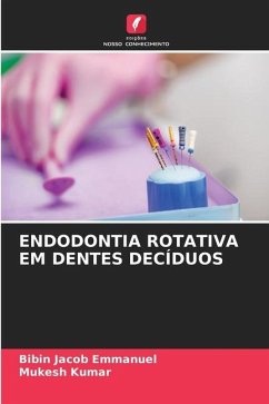 ENDODONTIA ROTATIVA EM DENTES DECÍDUOS - Emmanuel, Bibin Jacob;Kumar, Mukesh