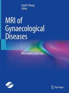 Cover MRI of Gynaecological Diseases (eBook, PDF)