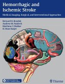 Hemorrhagic and Ischemic Stroke (eBook, ePUB)