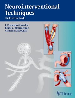 Neurointerventional Techniques (eBook, ePUB) - Gonzalez, Fernando L.; Albuquerque, Felipe C.; Mcdougall, Cameron G.