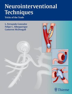 Cover Neurointerventional Techniques (eBook, ePUB)