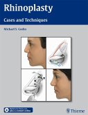 Rhinoplasty (eBook, ePUB)
