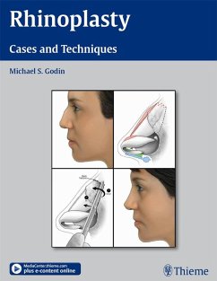 Rhinoplasty (eBook, ePUB) - Godin, Michael S.