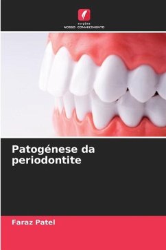 Patogénese da periodontite - Patel, Faraz