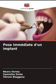 Pose immédiate d'un implant