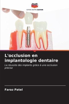 L'occlusion en implantologie dentaire - Patel, Faraz