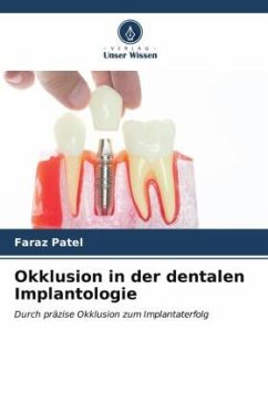 Okklusion in der dentalen Implantologie - Patel, Faraz