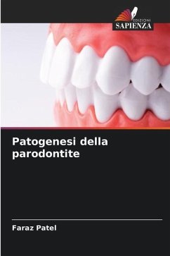 Patogenesi della parodontite - Patel, Faraz