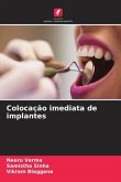 Colocação imediata de implantes