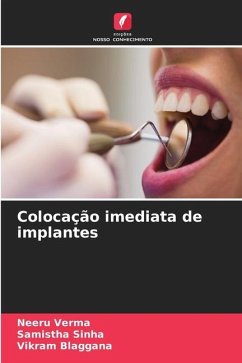 Colocação imediata de implantes - Verma, Neeru;Sinha, Samistha;Blaggana, Vikram