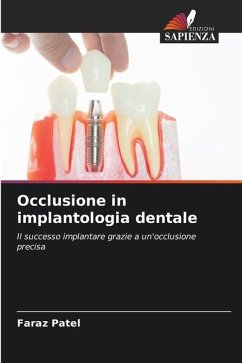 Occlusione in implantologia dentale - Patel, Faraz