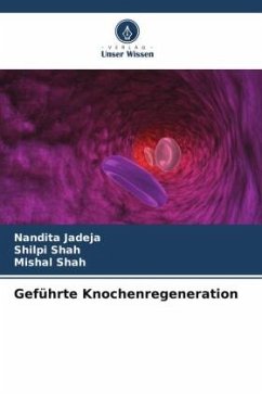 Geführte Knochenregeneration - Jadeja, Nandita;Shah, Shilpi;Shah, Mishal