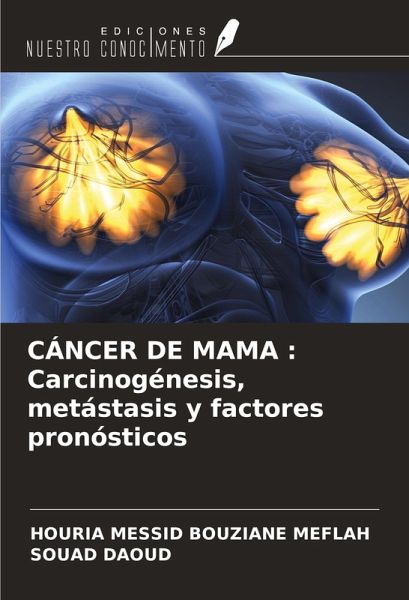 CÁNCER DE MAMA : Carcinogénesis, metástasis y factores pronósticos