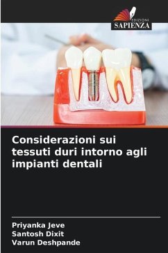 Considerazioni sui tessuti duri intorno agli impianti dentali - Jeve, Priyanka;Dixit, Santosh;Deshpande, Varun