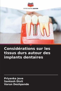 Considérations sur les tissus durs autour des implants dentaires - Jeve, Priyanka;Dixit, Santosh;Deshpande, Varun