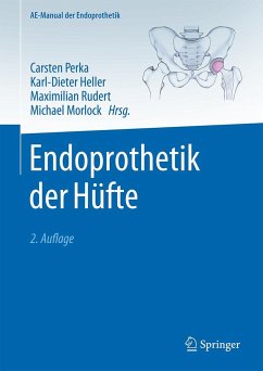 Endoprothetik der Hüfte
