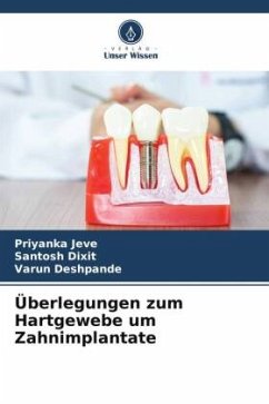 Überlegungen zum Hartgewebe um Zahnimplantate - Jeve, Priyanka;Dixit, Santosh;Deshpande, Varun