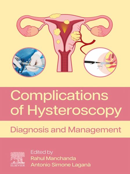 Complications of Hysteroscopy (eBook, ePUB)