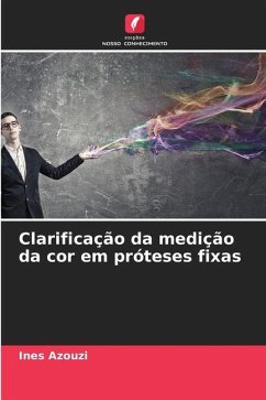 Clarificação da medição da cor em próteses fixas - Azouzi, Ines