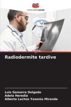 Radiodermite tardive - Gamarra Delgado, Luis;Heredia, Adela;Yasenia Miranda, Alberto Lachos