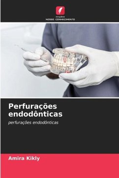 Perfurações endodônticas - Kikly, Amira