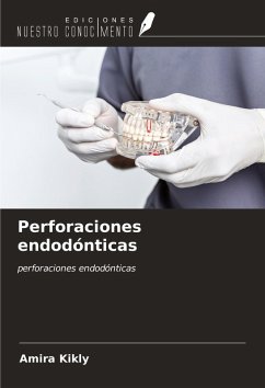 Cover Perforaciones endodónticas