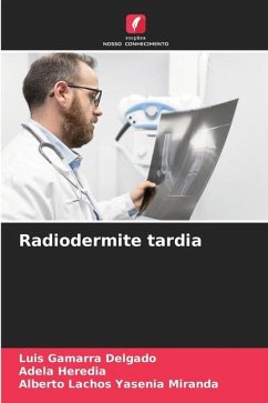 Radiodermite tardia - Gamarra Delgado, Luis;Heredia, Adela;Yasenia Miranda, Alberto Lachos