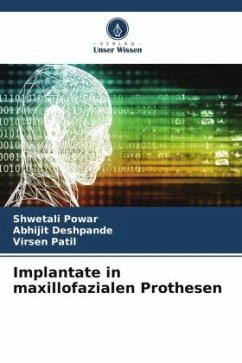 Implantate in maxillofazialen Prothesen - Powar, Shwetali;Deshpande, Abhijit;Patil, Virsen