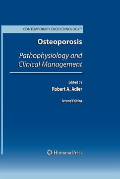 Cover Osteoporosis (eBook, ePUB)