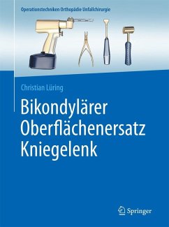 Cover Bikondylärer Oberflächenersatz Kniegelenk (eBook, ePUB)