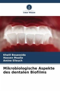 Mikrobiologische Aspekte des dentalen Biofilms - Bouassida, Khalil;Moalla, Hassen;Elleuch, Amine