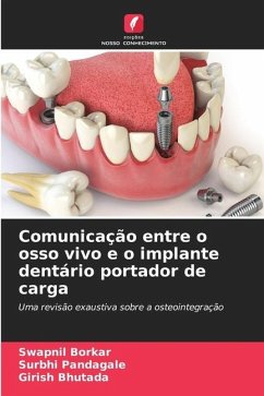 Comunicação entre o osso vivo e o implante dentário portador de carga - Borkar, Swapnil;Pandagale, Surbhi;Bhutada, Girish