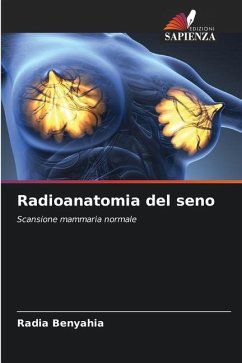 Radioanatomia del seno - BENYAHIA, Radia