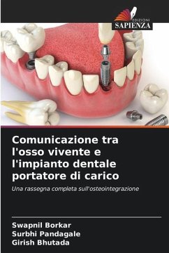 Comunicazione tra l'osso vivente e l'impianto dentale portatore di carico - Borkar, Swapnil;Pandagale, Surbhi;Bhutada, Girish