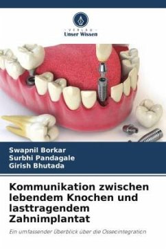 Kommunikation zwischen lebendem Knochen und lasttragendem Zahnimplantat - Borkar, Swapnil;Pandagale, Surbhi;Bhutada, Girish