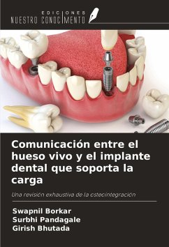 Cover Comunicación entre el hueso vivo y el implante dental que soporta la carga